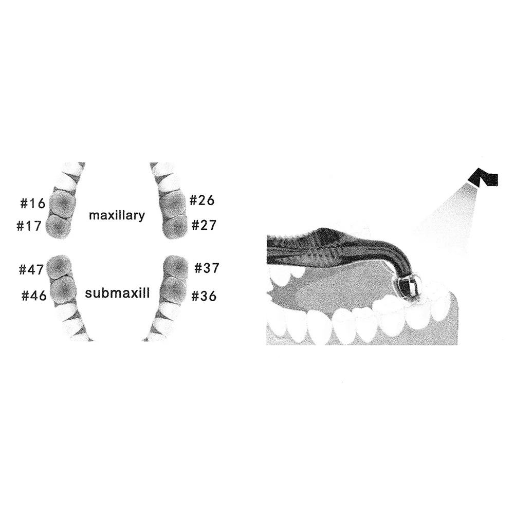 Kit Pencetakan 3D Gigi Belakan - 3D Printing Orthodontics ulasan dan harga