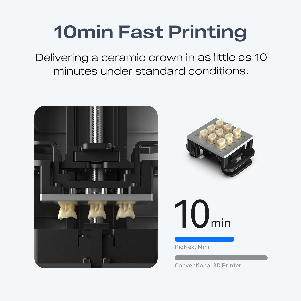 Printer 3D Gigi Mini Presisi T - 3D Printing Orthodontics ulasan dan harga
