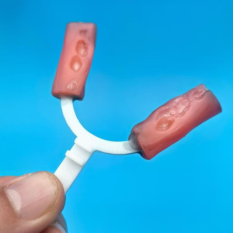 10Pcs/Bag Dental Bite Fork Ort - 3D Printing Orthodontics ulasan dan harga